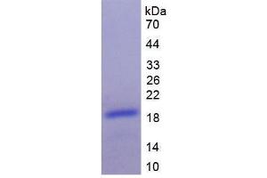 Image no. 1 for Brain Natriuretic Peptide (BNP) (AA 77-121) protein (His tag,SUMO Tag) (ABIN6236664) (BNP Protein (AA 77-121) (His tag,SUMO Tag))