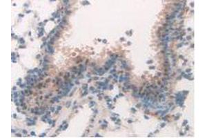 IHC-P analysis of Mouse Lung Tissue, with DAB staining. (MAPK7 抗体  (AA 185-419))