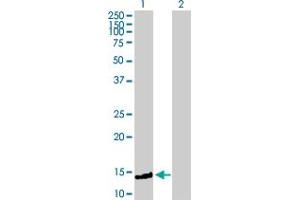Western Blot analysis of FXC1 expression in transfected 293T cell line by FXC1 MaxPab polyclonal antibody. (TIMM10B 抗体  (AA 1-103))