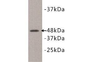 Western Blotting (WB) image for anti-Kinase D-Interacting Substrate, 220kDa (KIDINS220) antibody (ABIN1854930) (KIDINS220 抗体)