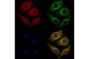 ABIN6261132 and ABIN6272283 staining Hela cells by IF/ICC. (CYB561D1 抗体  (C-Term))