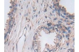Immunohistochemistry (IHC) image for anti-Proprotein Convertase Subtilisin/kexin Type 5 (PCSK5) (AA 115-454) antibody (ABIN7435742)