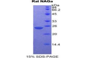 SDS-PAGE analysis of Rat NAGa Protein. (NAGA 蛋白)