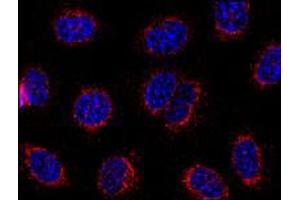 Immunofluorescence staining of HeLa cells using STIM1 monoclonal antibody, clone CDN3H4 . (STIM1 抗体  (C-Term))