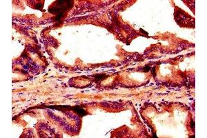 Immunohistochemistry of paraffin-embedded human prostate tissue using ABIN7161004 at dilution of 1:100 (NOX1 抗体  (AA 418-564))