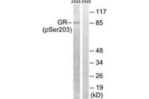 Western blot analysis of extracts from A549 cells treated with dexamethason 10nM 1h, using GR (Phospho-Ser203) Antibody. (GR (AA 171-220), (pSer203) 抗体)