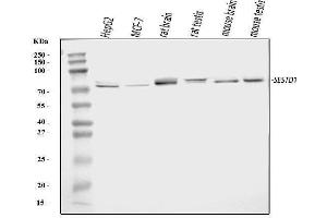 Western blot analysis of Solo/SESTD1 using anti-Solo/SESTD1 antibody (ABIN7602009).