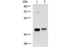 Western blot analysis of Mouse brain tissue and Human fetal brain tissue lysates using GNAZ Polyclonal Antibody at dilution of 1:1300 (GNaZ 抗体)