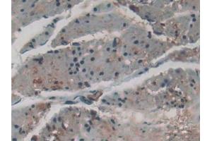 Immunohistochemistry (IHC) image for anti-Forkhead Box O1 (FOXO1) (AA 333-557) antibody (ABIN7432556)