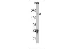 Image no. 1 for anti-Lysine (K)-Specific Demethylase 6B (Kdm6b) (N-Term) antibody (ABIN356549) (Kdm6b 抗体  (N-Term))