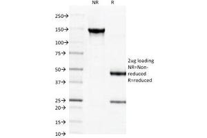 SDS-PAGE Analysis of Purified, BSA-Free Spectrin beta III Antibody (clone SPTBN2/1584). (Spectrin, Beta, Non-erythrocytic 2 (SPTBN2) (AA 356-475) 抗体)