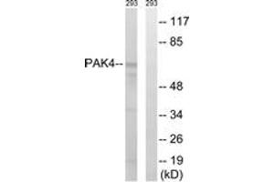 Western blot analysis of extracts from K562 cells, treated with PMA 125ng/ml 30', using PAK4/5/6 (Ab-474) Antibody. (PAK4 抗体  (AA 441-490))