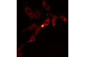 ABIN6278574 staining HeLa cells by IF/ICC. (GIT1 抗体  (Internal Region))