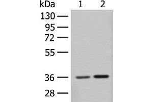 Western blot analysis of Mouse brain tissue and Rat brain tissue lysates using SLC25A27 Polyclonal Antibody at dilution of 1:350 (SLC25A27 抗体)