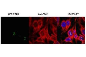 Immunofluorescence microscopy of HeLa cells transfected with GFP-PBK1. (RSL1D1 抗体)