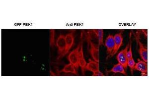 Immunofluorescence microscopy of HeLa cells transfected with GFP-PBK1.