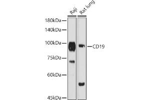 Western blot analysis of extracts of various cell lines, using CD19 antibody (ABIN3023663, ABIN3023664, ABIN3023665 and ABIN6219683) at 1:1000 dilution. (CD19 抗体  (AA 351-556))