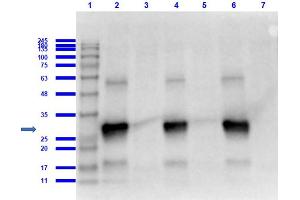 Western Blotting (WB) image for anti-Red Fluorescent Protein (RFP) antibody (ABIN129578)