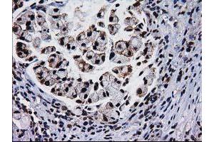 Image no. 13 for anti-Nonhomologous End-Joining Factor 1 (NHEJ1) antibody (ABIN1499728)