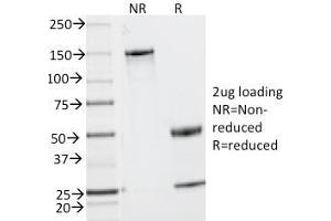 SDS-PAGE Analysis Purified MUC2 Mouse Monoclonal Antibody (MLP/842). (MUC2 抗体)