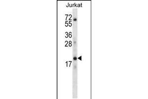 Western blot analysis in Jurkat cell line lysates (35ug/lane). (KRTAP13-3 抗体  (C-Term))
