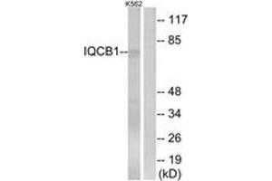 Western Blotting (WB) image for anti-IQ Motif Containing B1 (IQCB1) (AA 431-480) antibody (ABIN2890388) (IQCB1 抗体  (AA 431-480))
