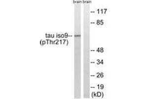 Western blot analysis of extracts from rat brain, using Tau (Phospho-Thr534/217) Antibody. (tau 抗体  (pThr534))