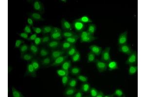 Immunofluorescence analysis of U2OS cells using MAD1L1 antibody. (MAD1L1 抗体)