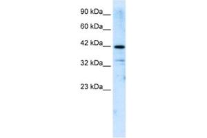 Western Blotting (WB) image for anti-Zinc Finger and SCAN Domain Containing 31 (ZSCAN31) antibody (ABIN2461279) (Zinc Finger and SCAN Domain Containing 31 (ZSCAN31) 抗体)
