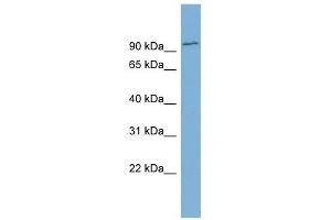 FBXO34 antibody used at 1 ug/ml to detect target protein. (FBXO34 抗体  (Middle Region))