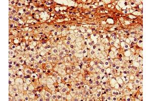 IHC image of ABIN7151093 diluted at 1:600 and staining in paraffin-embedded human adrenal gland tissue performed on a Leica BondTM system. (Parkin 抗体  (AA 1-465))