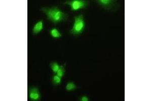 Detection of HDGF in A549 cells using Polyclonal Antibody to Hepatoma Derived Growth Factor (HDGF) (HDGF 抗体  (AA 10-240))