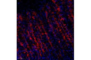 Immunofluorescence of paraffin embedded rat stomach using Treh (ABIN7076006) at dilution of 1:650 (250x lens) (TREH 抗体)