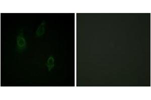 Immunofluorescence analysis of HepG2 cells, using PKC-pan (Phospho-Thr497) Antibody. (PKC 抗体  (pThr497))