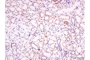 Paraformaldehyde-fixed, paraffin embedded human kidney tissue, Antigen retrieval by boiling in sodium citrate buffer(pH6) for 15min, Block endogenous peroxidase by 3% hydrogen peroxide for 30 minutes, Blocking buffer (normal goat serum) at 37°C for 20min, Antibody incubation with Rabbit Anti-EphB2 R Polyclonal Antibody, Unconjugated  at 1:200 overnight at 4°C, followed by a conjugated secondary and DAB staining (EphB2 R (AA 101-200) 抗体)