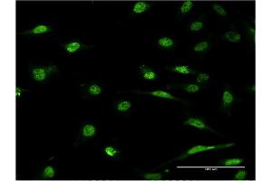 Immunofluorescence of monoclonal antibody to ID1 on HeLa cell. (ID1 抗体  (AA 1-155))