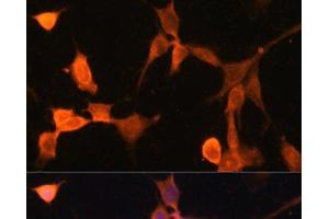 Immunofluorescence analysis of NIH-3T3 cells using CACYBP Polyclonal Antibody at dilution of 1:100. (CACYBP 抗体)