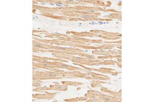 Immunohistochemical analysis of paraffin-embedded human heart tissue using (ABIN6244160 and ABIN6578849) performed on the Leica® BOND RXm. (MYL2 抗体  (AA 42-75))