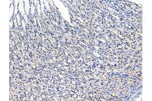 ABIN7094764 and ABIN7098815 at 1/100 staining Rat stomach tissue by IHC-P. (ADCY10 抗体  (N-Term))