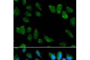Immunofluorescence analysis of MCF-7 cells using IL1RN Polyclonal Antibody (IL1RN 抗体)
