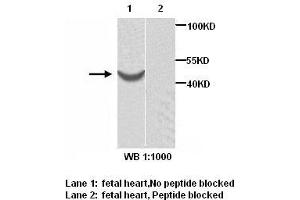 Image no. 1 for anti-ARP1 Actin-Related Protein 1 Homolog B, Centractin beta (ACTR1B) antibody (ABIN1574450)