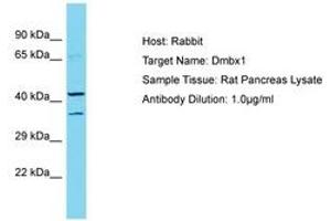 Image no. 1 for anti-Diencephalon/mesencephalon Homeobox 1 (DMBX1) (AA 191-240) antibody (ABIN6750283) (DMBX1 抗体  (AA 191-240))