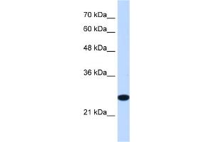 WB Suggested Anti-TMEM109 Antibody Titration:  1. (TMEM109 抗体  (Middle Region))
