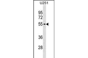 KLHDC7B Antibody (C-term) (ABIN1537171 and ABIN2838249) western blot analysis in  cell line lysates (35 μg/lane).