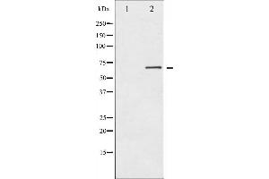 Western blot analysis of PKR expression in Starvation treated K562 whole cell lysates,The lane on the left is treated with the antigen-specific peptide.
