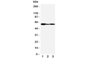 Western blot testing of GPR30 antibody and Lane 1:  human COLO320;  2: (h) MCF-7;  3: monkey COS7 cell lysate.