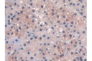 Detection of PDXK in Rat Adrenal gland Tissue using Polyclonal Antibody to Pyridoxal Kinase (PDXK)