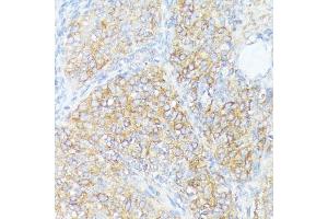 Immunohistochemistry of paraffin-embedded rat ovary using SLC7 antibody (ABIN7270481) at dilution of 1:100 (40x lens). (SLC7A2 抗体  (C-Term))