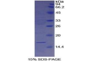 SDS-PAGE (SDS) image for Galectin 7 (LGALS7) (AA 1-136) protein (His tag) (ABIN1170487)