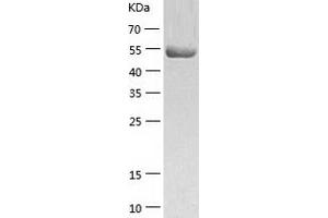 Western Blotting (WB) image for Thioredoxin Reductase 1 (TXNRD1) (AA 2-499) protein (His tag) (ABIN7125363) (TXNRD1 Protein (AA 2-499) (His tag))